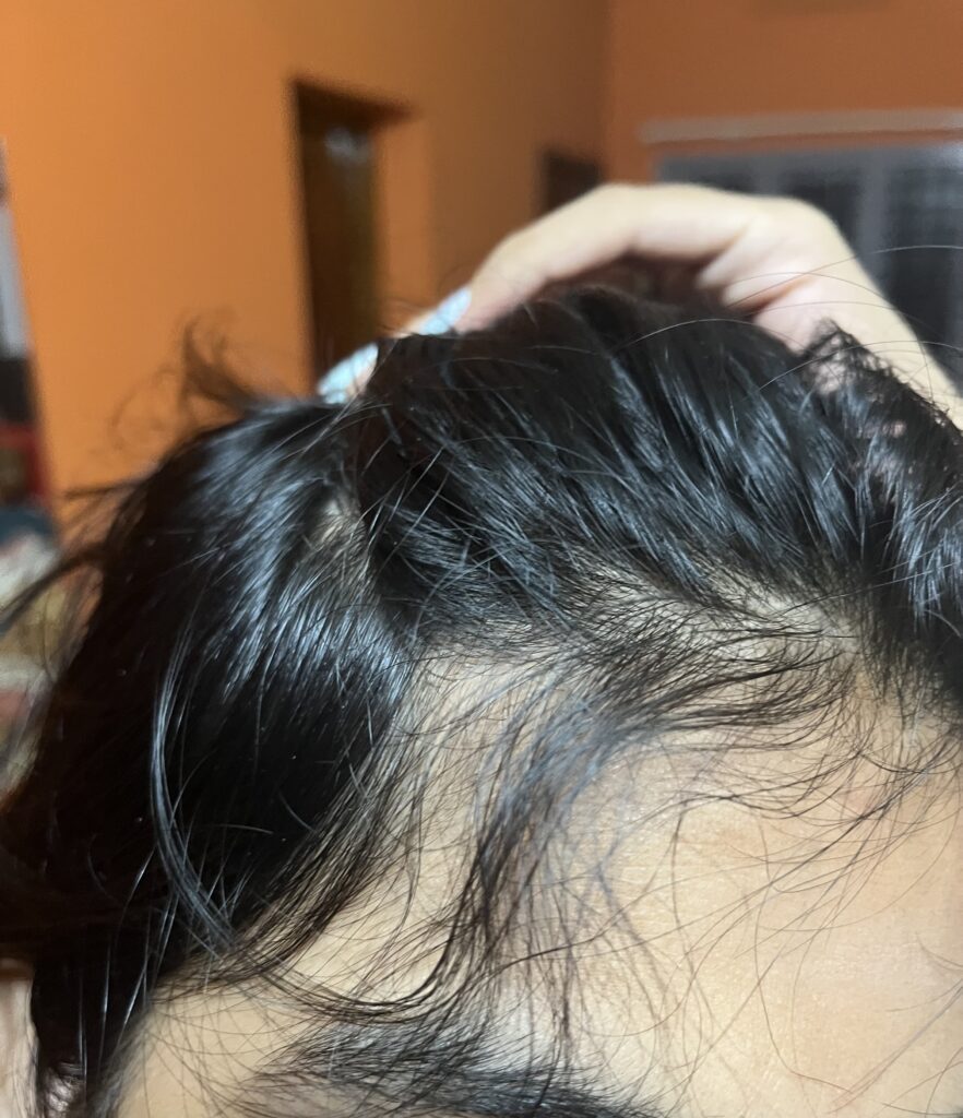 Image #1 from Nimmi Aravind